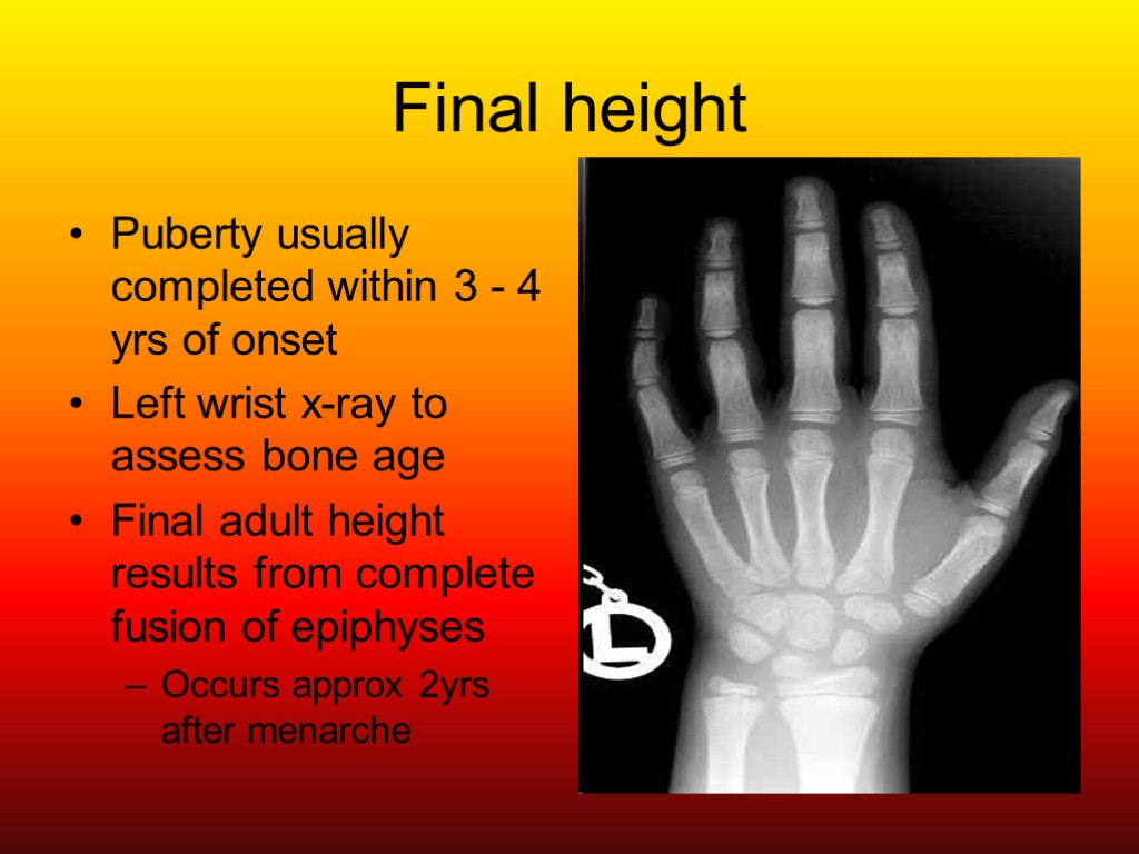 Final height Puberty usually completed within 3 - 4 yrs of onset Left wrist